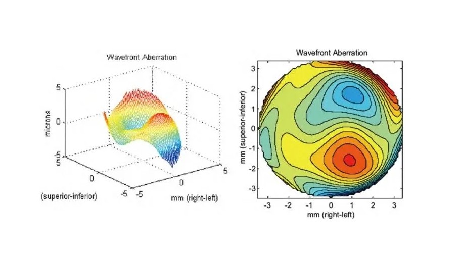 波前像差（波阵面像差）的基本知识