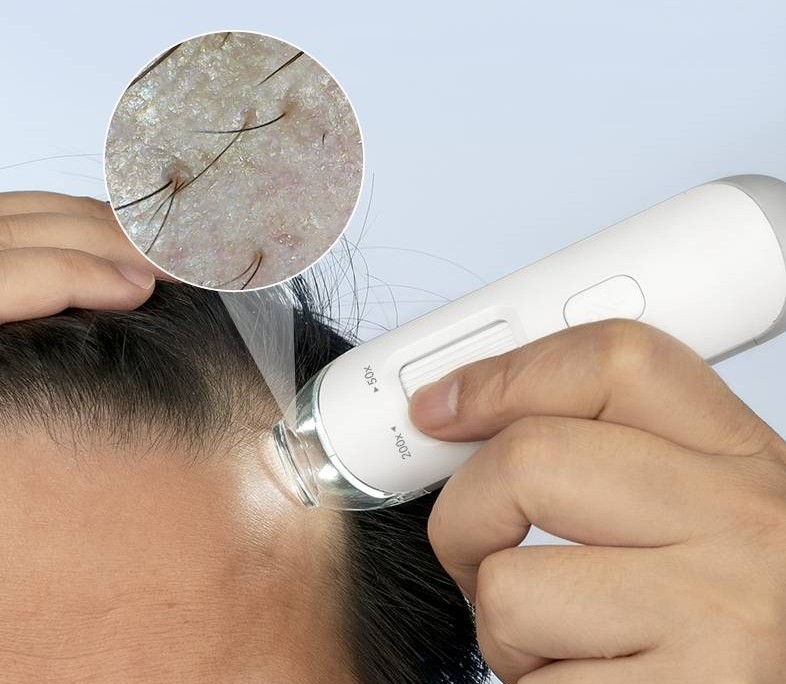 头皮检测仪原理