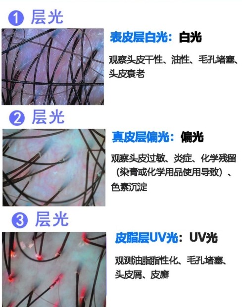 不同光对头发的观测效果