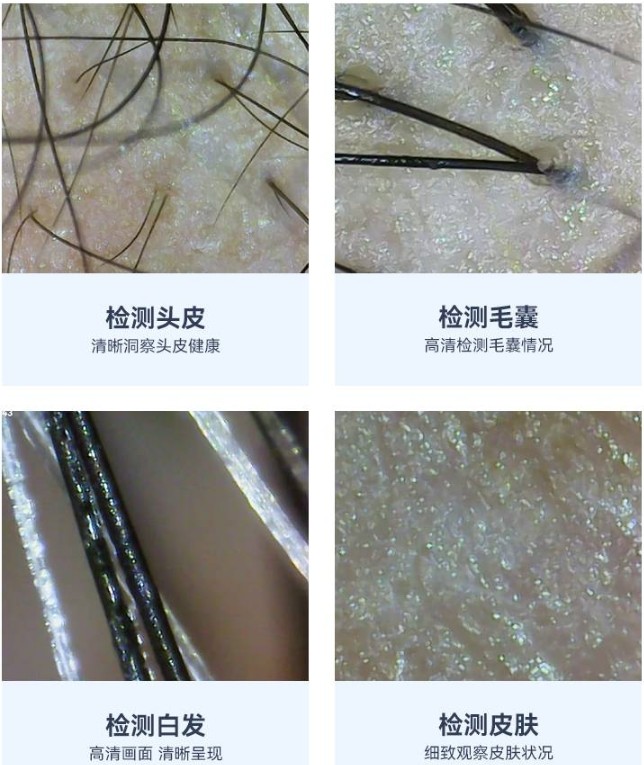 头皮检测仪的功能效果