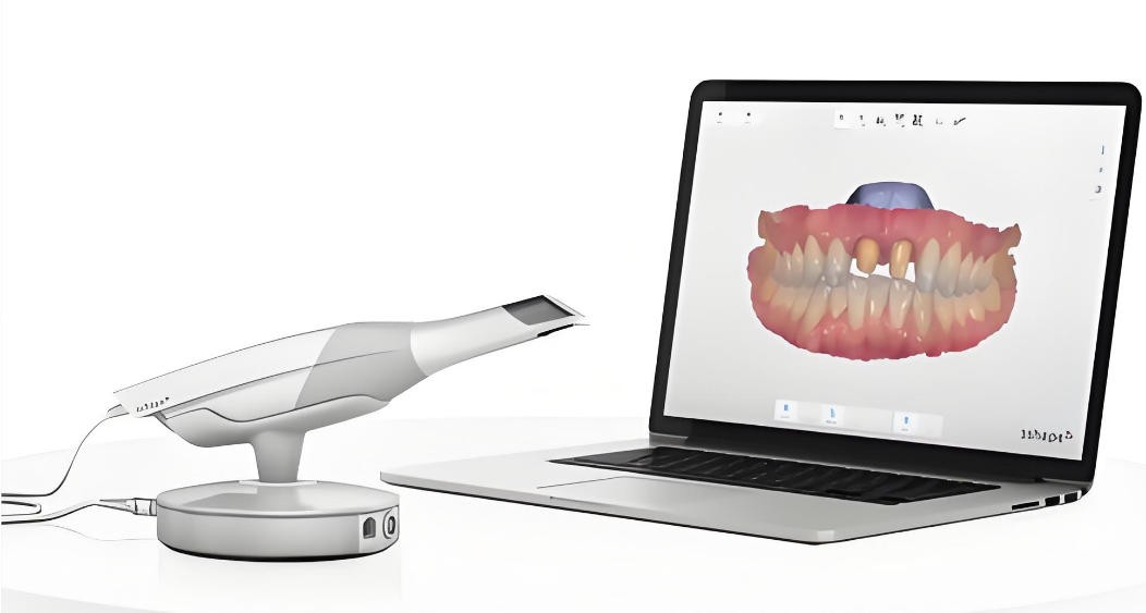 三维口内扫描仪